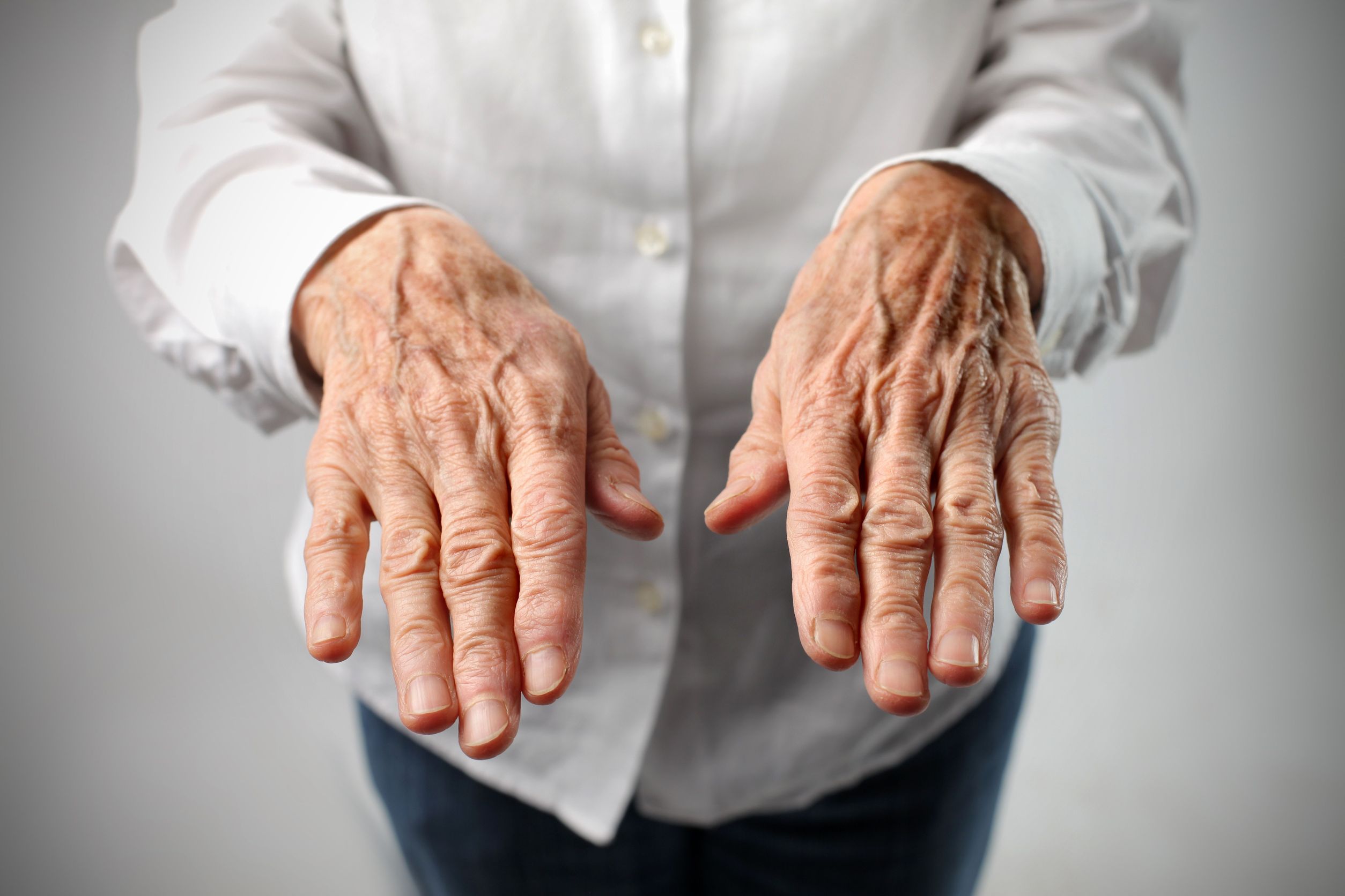 restore old looking hands to young hands