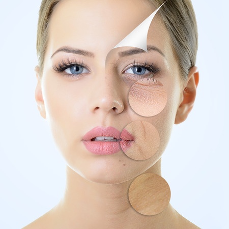 Glycation causes premature aging!