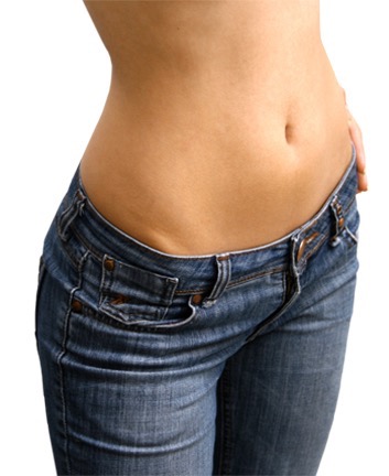 Get rid of stretch marks with Laser Genesis
