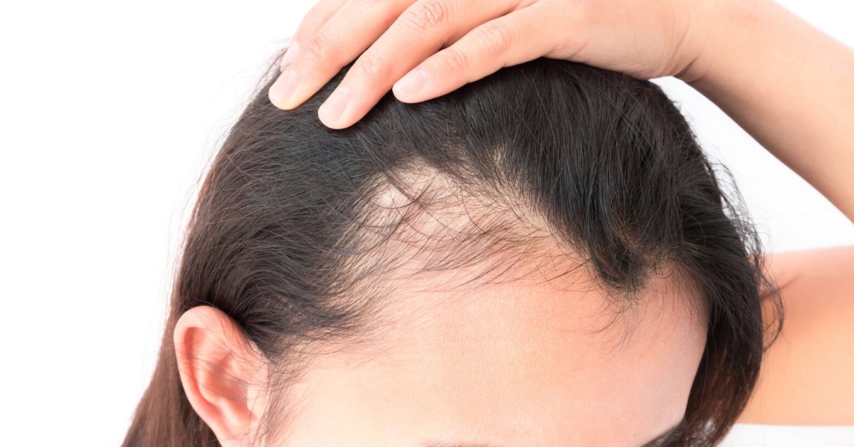 Spectral.DNC-N® topical spray is the first topical hair-loss treatment to employ Nanoxidil® to increase production of growth with no side effects