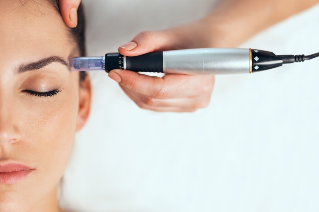Is-A-SkinPen-Microneedling-Procedure-Right-1024x683 Microneedling for beautiful skin
